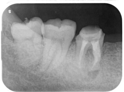 伴_昌彦_ライトボックス(3)_口腔内_20200905_161355 2.jpg
