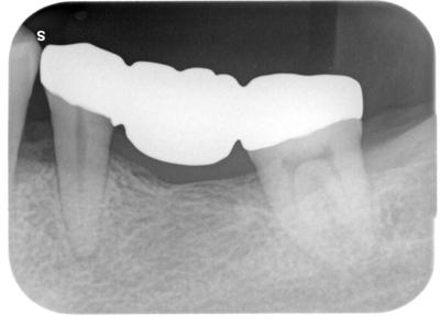 多田_直樹_ライトボックス(1)_口腔内_20210826_100319 2.jpg